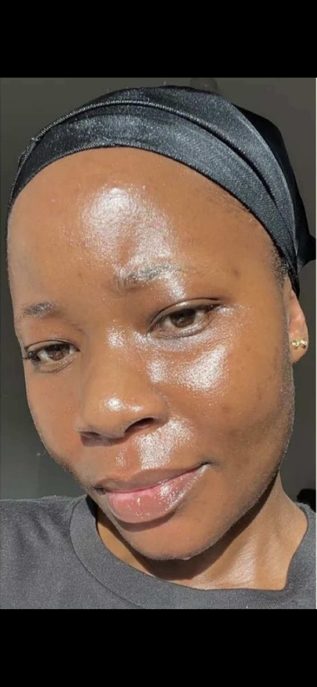 Kefilwe before